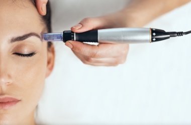 Microneedling - revitalizace pleti pomocí mikrojehliček